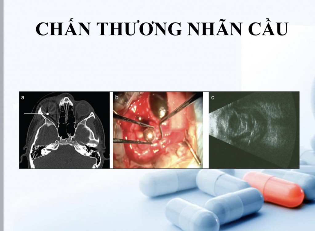 Các chuyên gia tư vấn chăm sóc mắt học đường cho trẻ