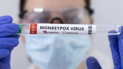 Phát hiện bệnh nhân đầu tiên mắc bệnh đậu mùa khỉ tại Việt Nam