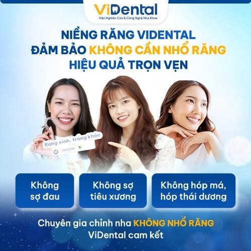 Niềng răng đẹp - nhanh - không tái niềng tại ViDental