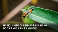 Hà Nội: Nhiều ca bệnh viêm da nặng do tiếp xúc với kiến ba khoang