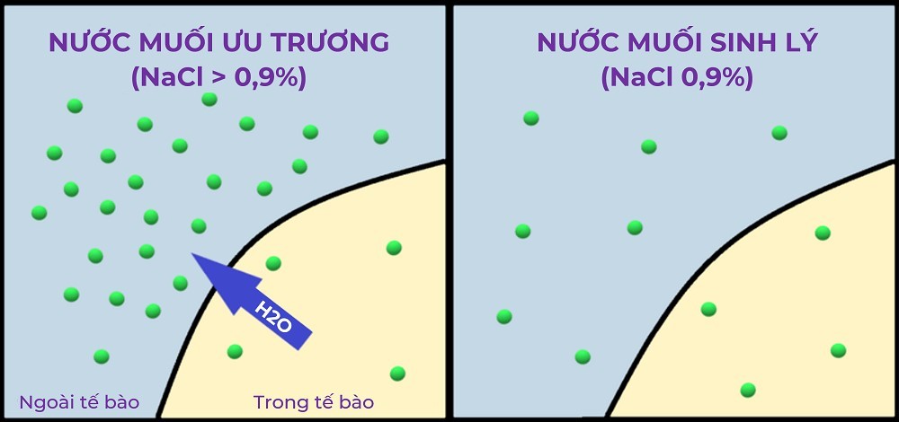 Nước muối ưu trương có tác dụng gì? Cách sử dụng thế nào?