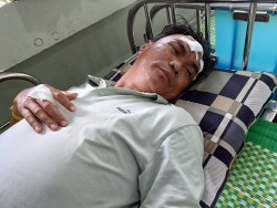 Quảng Nam: Xem World Cup, một người dân bị đánh trọng thương