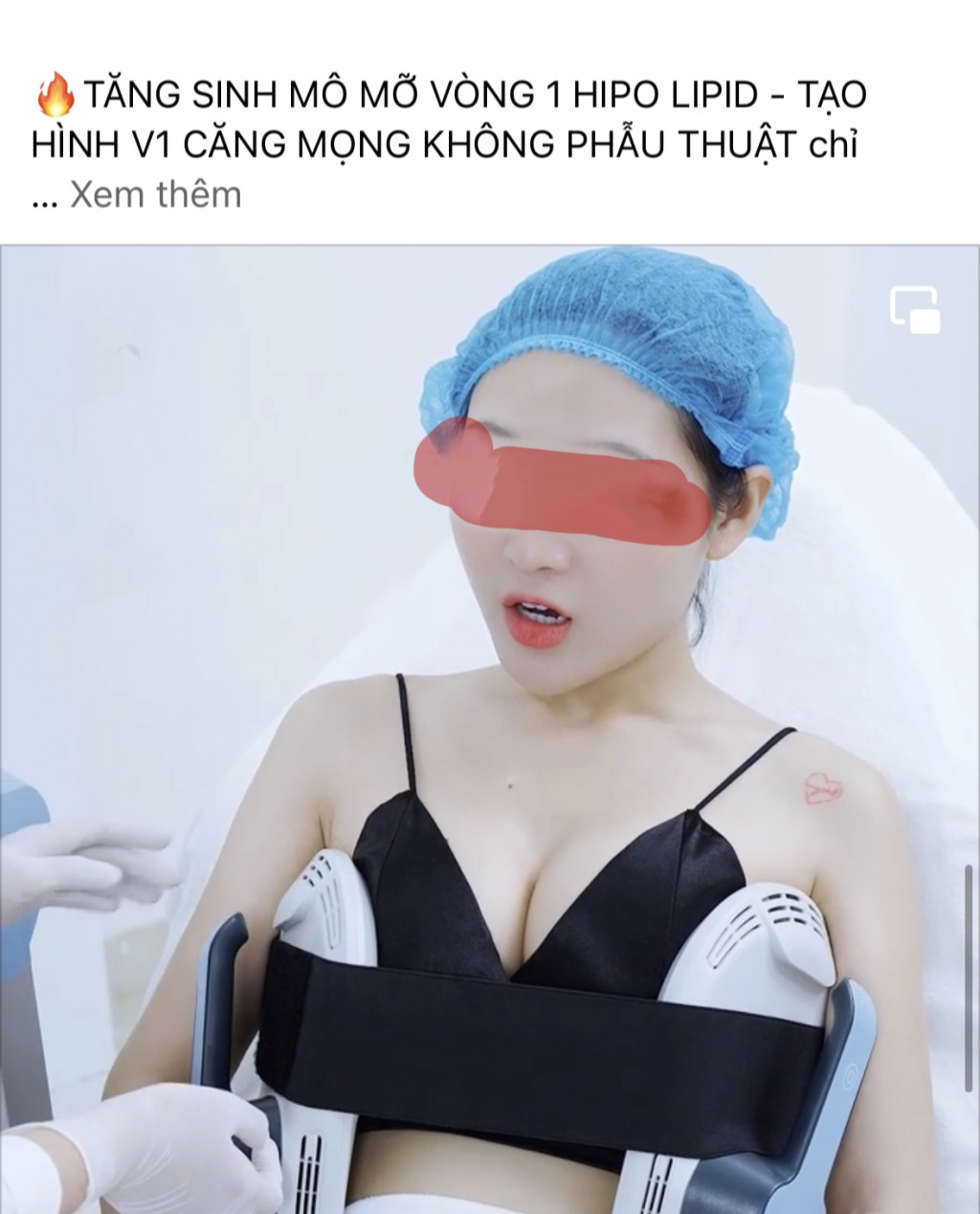 Tổn thương ngực vì tin vào các chiêu trò quảng cáo "nâng ngực không phẫu thuật"