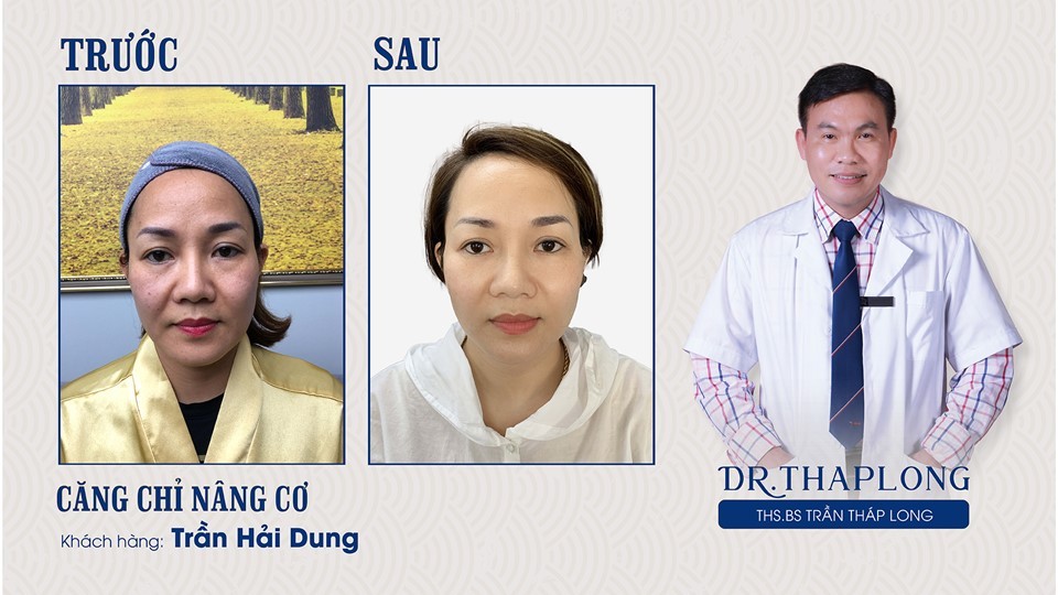 Chuyện nghề “căng chỉ” của một bác sĩ