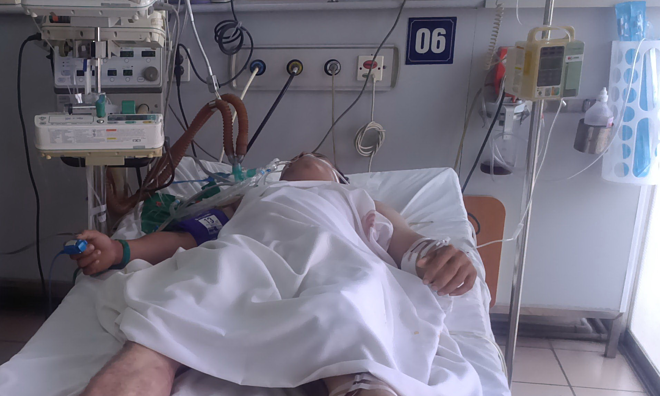 Một bệnh nhân bị ngộ độc sâu ban miêu cấp cứu tại Bệnh viện Bạch Mai. Ảnh do bác sĩ cung cấp.