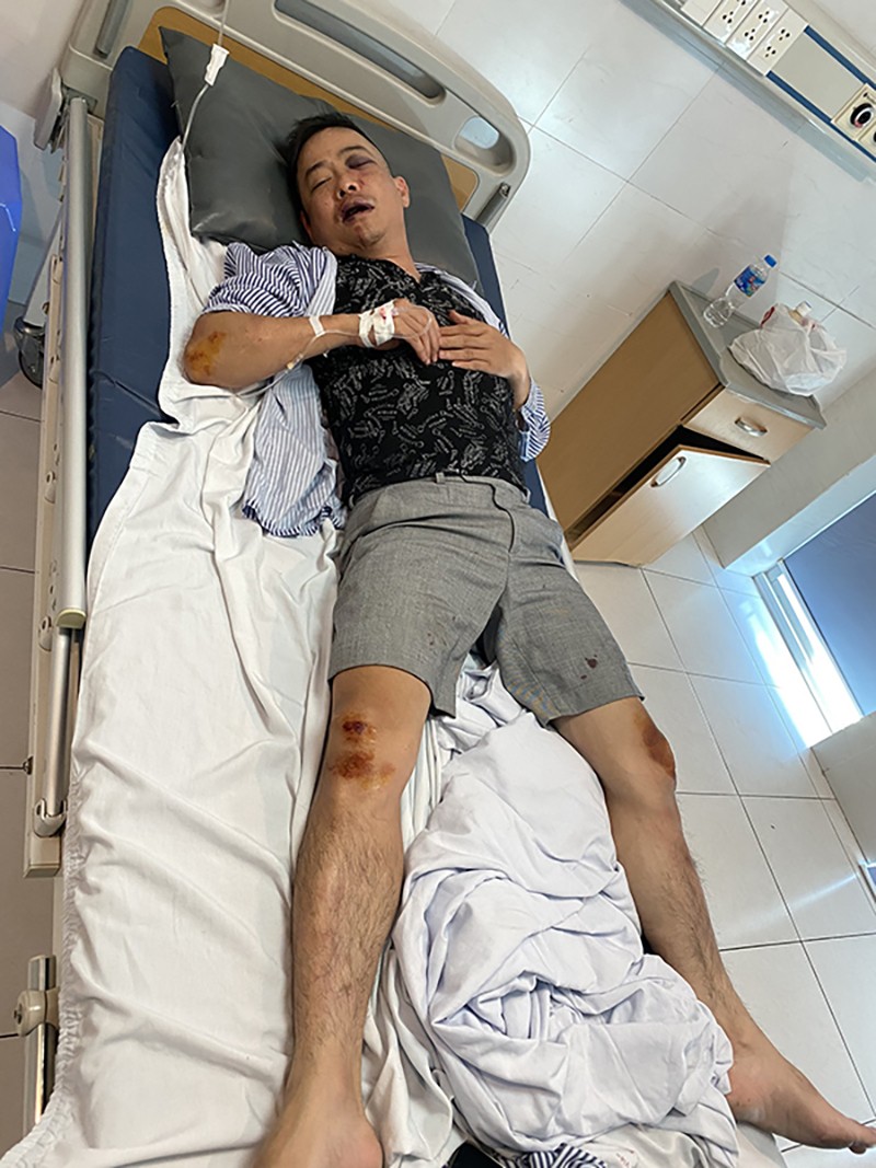 Anh Việt Anh với nhiều thương tích đang nằm điều trị tại bệnh viện