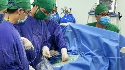 Phẫu thuật nội soi cắt thận phụ cho bệnh nhân dị tật niệu quản đôi