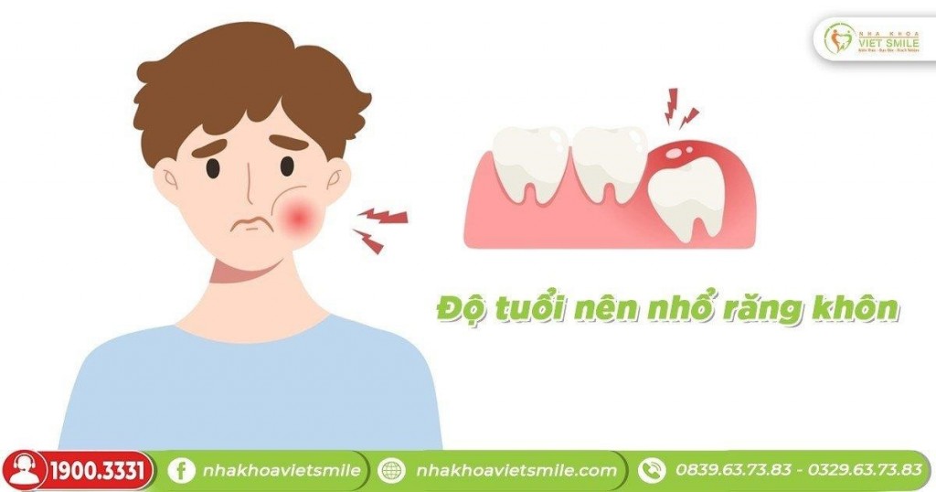 Độ tuổi phù hợp để nhổ răng khôn