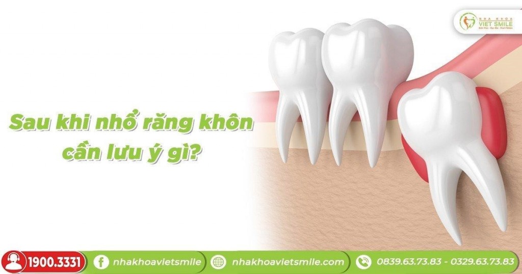 Lưu ý cần thiết sau khi nhổ răng 8