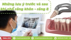 Những lưu ý trước và sau khi nhổ răng khôn - răng 8