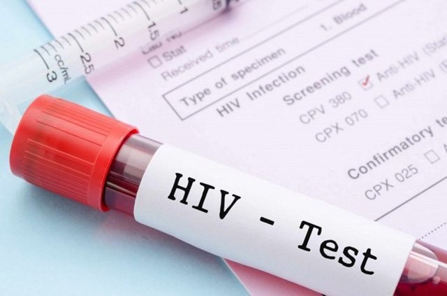 Xét nghiệm HIV tại cộng đồng không có nguy cơ làm lây nhiễm HIV