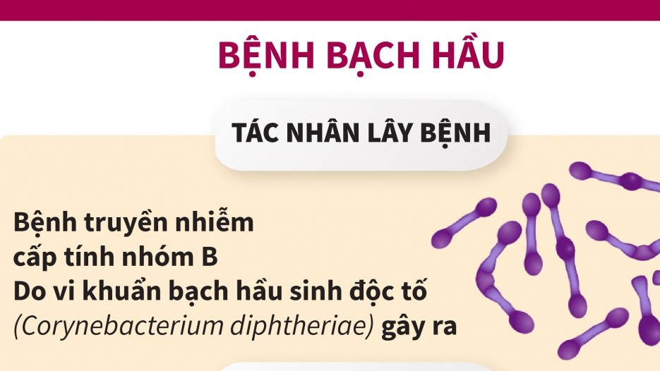 Bệnh bạch hầu: Biến chứng đáng sợ và cách phòng ngừa