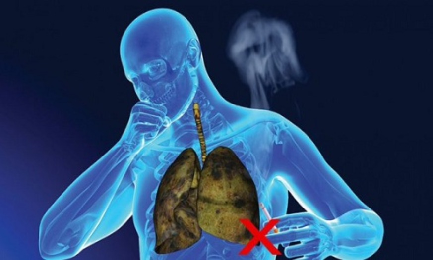 Thuốc lá là kẻ thù của lá phổi khỏe mạnh
