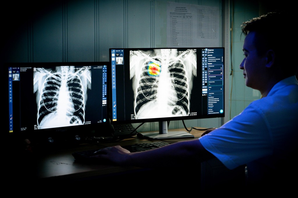   Hình chụp X-quang từ DrAid™ lao phổi có độ chính xác lên tới 95%, rút ngắn thời gian phát hiện bệnh, giảm chi phí sàng lọc.