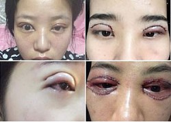 Viện thẩm mỹ bị phạt 141 triệu đồng, tước giấy phép 4 tháng