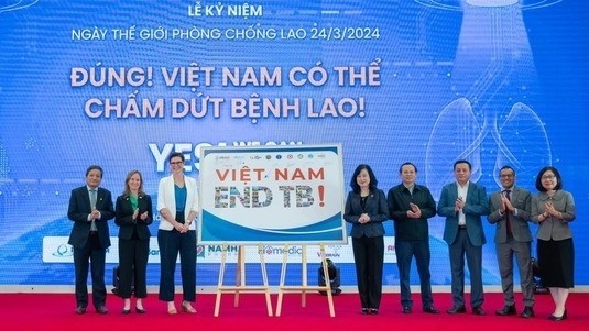 Việt Nam nỗ lực chấm dứt bệnh lao vào năm 2030