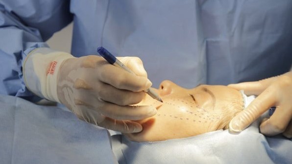 Phẫu thuật căng da mặt có thể gây nhiều biến chứng nguy hiểm
