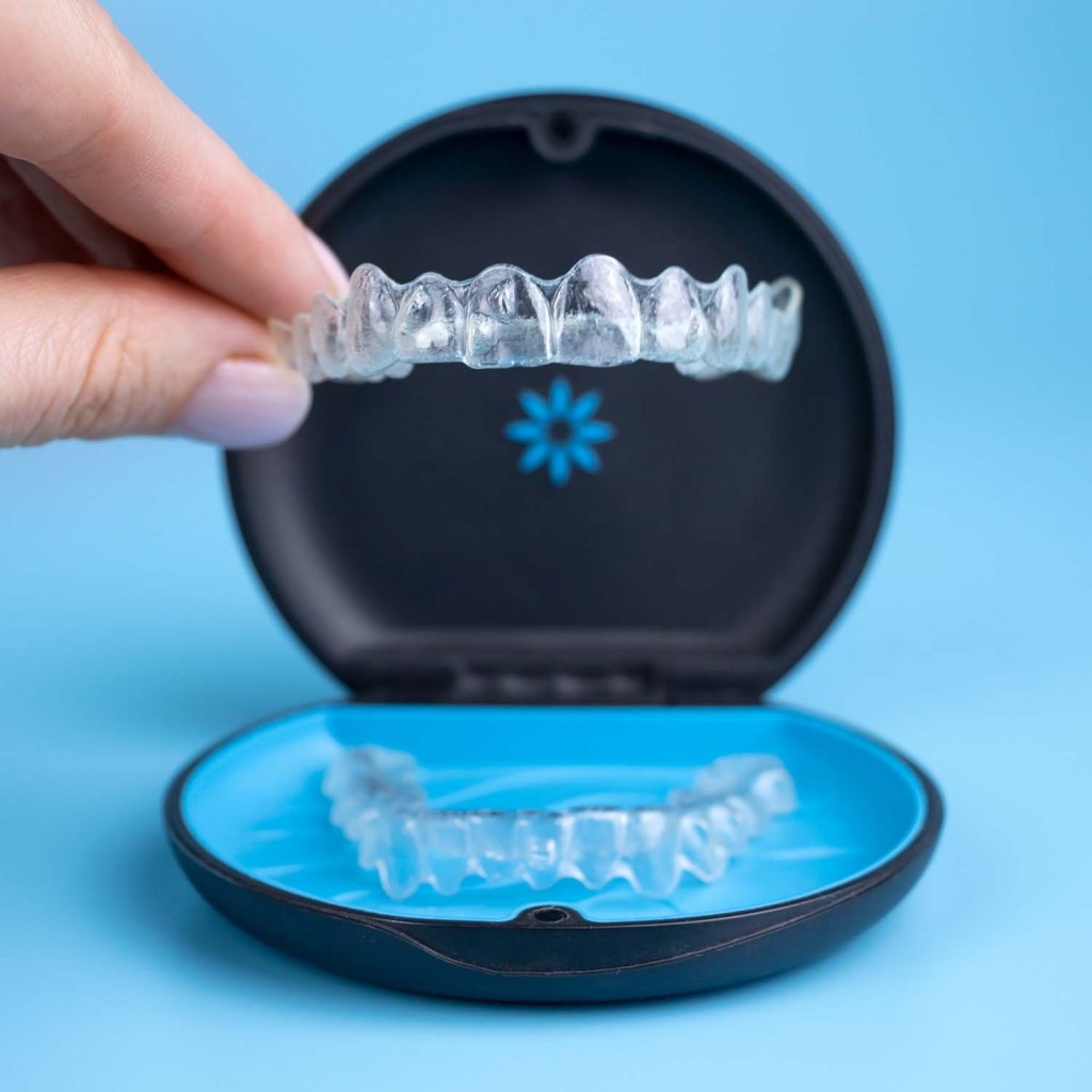 Ưu điểm tuyệt vời của niềng răng Invisalign