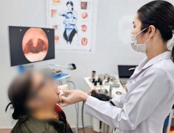 Ho kéo dài không rõ nguyên do có dị vật "ẩn náu" trong khe amidan trái
