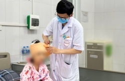 Hà Nội: Bé gái 5 tuổi bị chó nhà cắn liên tiếp vào đầu - mặt