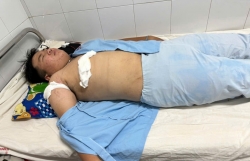 Bình Định: Nam thanh niên bị đâm trọng thương trên đường về nhà
