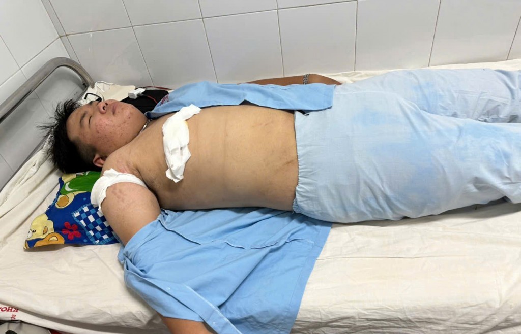 Bình Định: Nam thanh niên bị đâm trọng thương trên đường về nhà