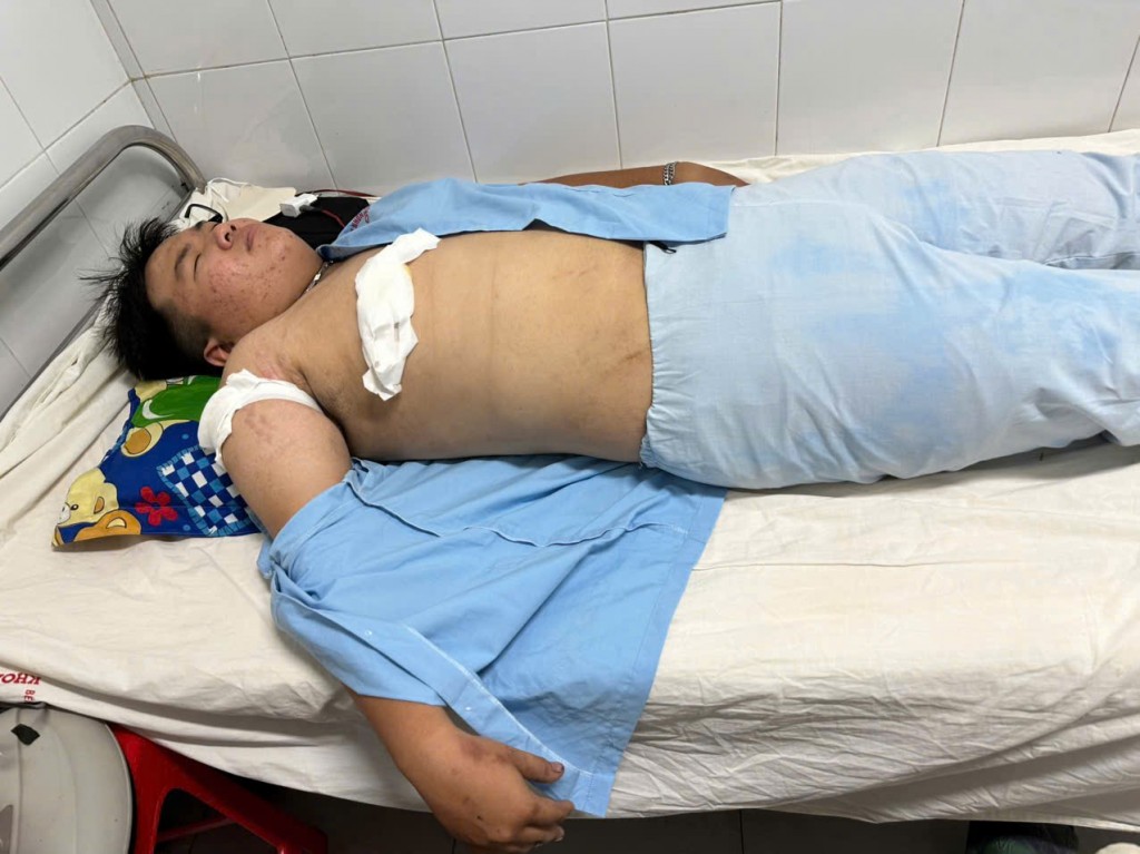 Nguyễn Hoàng Quốc Việt đang được điều trị tích cực tại Trung tâm Y tế TP Quy Nhơn sau khi trở thành nạn nhân của vụ hành hung bằng dao (Ảnh: Quang Khang)