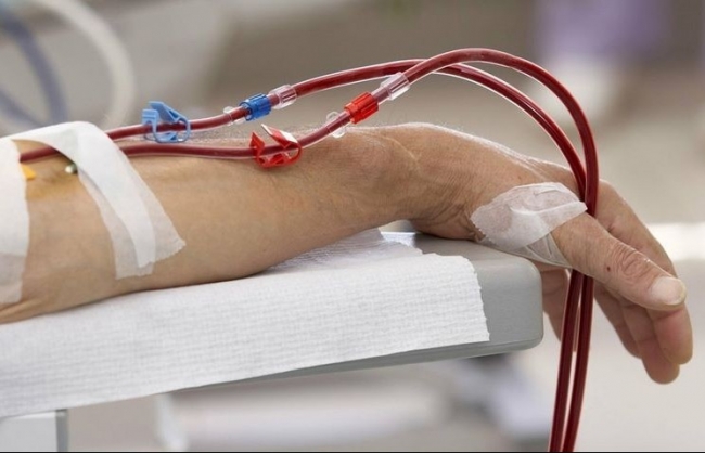 Cảnh giác với triệu chứng thận "kêu cứu"