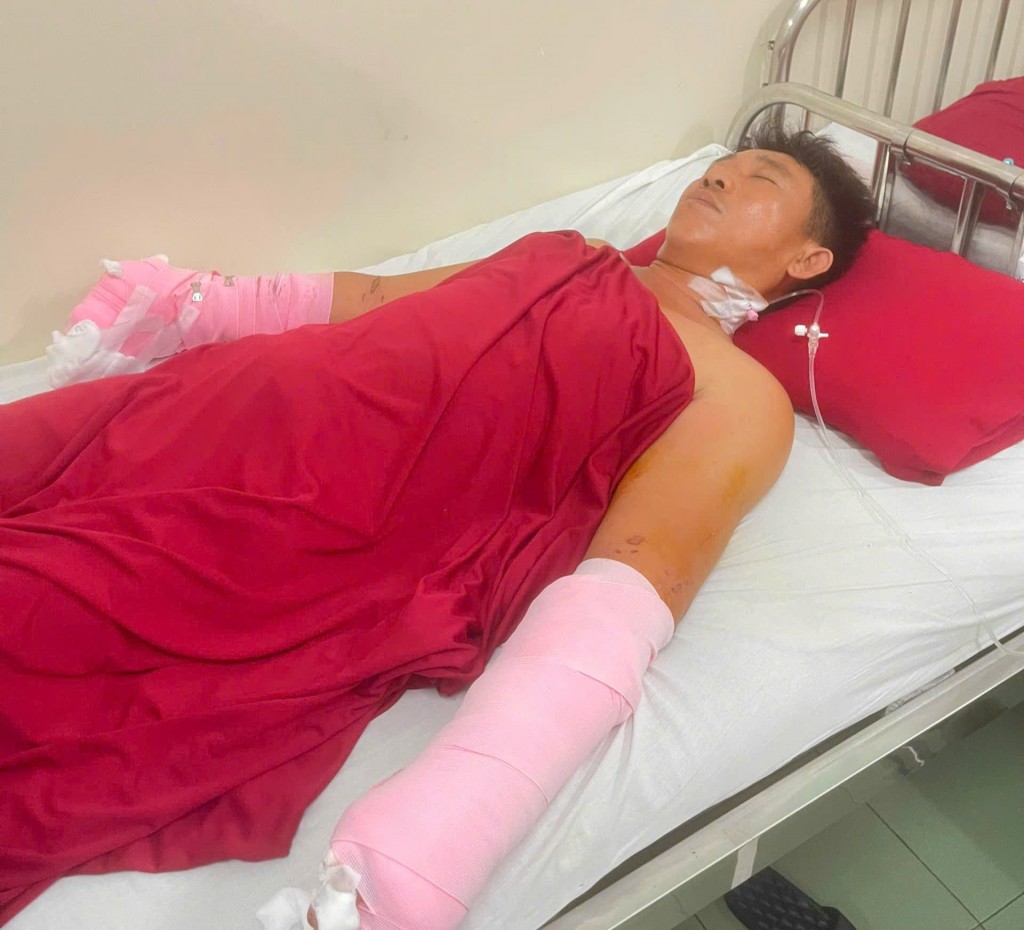 Anh Đỗ Văn Hùng đang điều trị tại bệnh viện Trung ương Huế trong tình trạng nguy kịch 