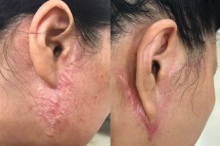 Nguy hiểm rình rập từ các cơ sở làm đẹp không phép