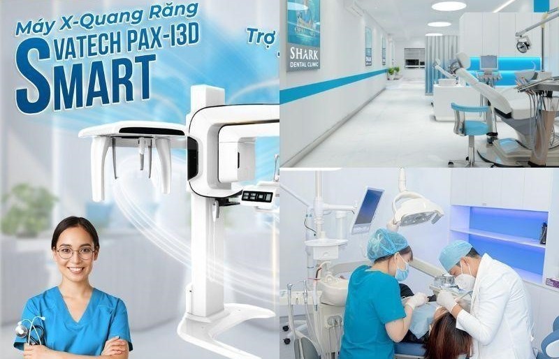 Khám phá địa chỉ trám răng uy tín ở Hà Nội