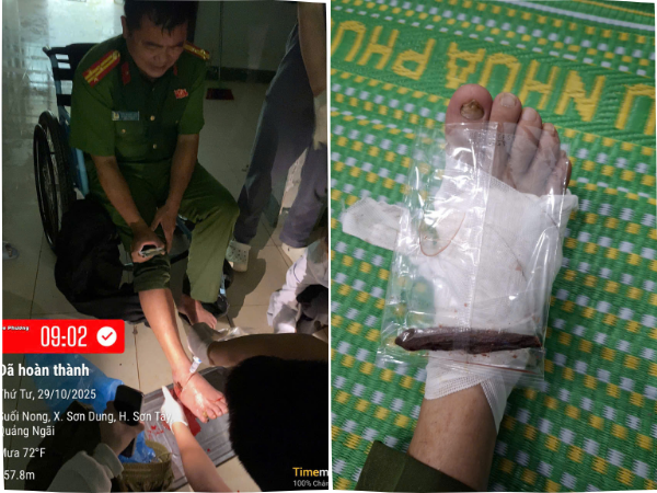 Trưởng Công an xã bị thương nặng khi giúp dân chống lũ