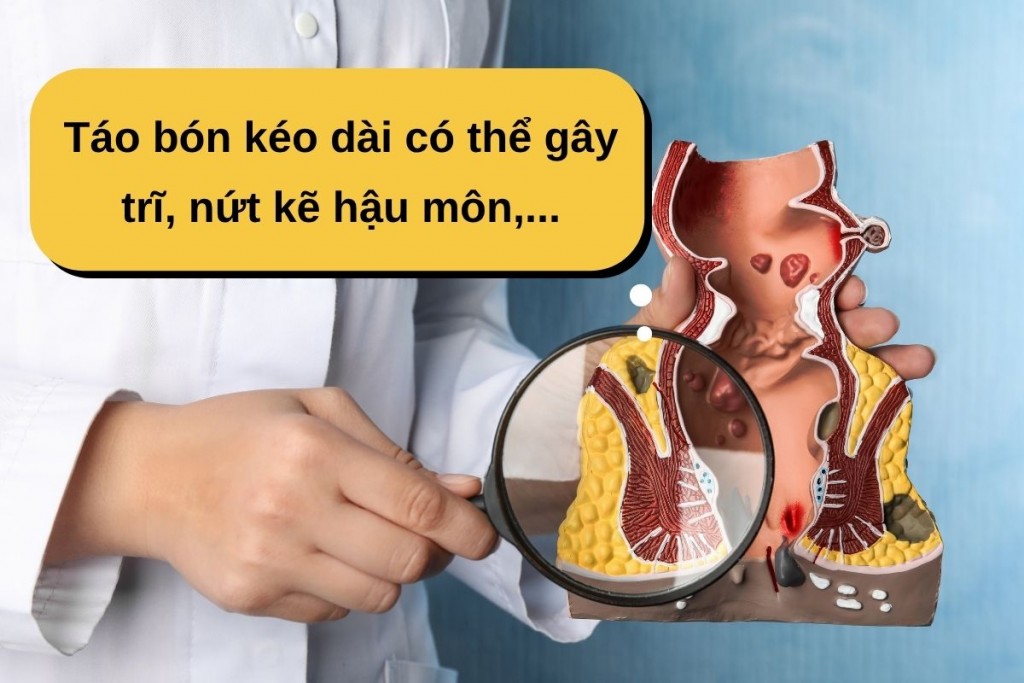 Quả mơ Traditaz Ume Fiber Plum: Bí quyết nhẹ bụng, hỗ trợ giảm táo bón tự nhiên Quả mơ Traditaz Ume Fiber Plum: Bí quyết nhẹ bụng, hỗ trợ giảm táo bón tự nhiên