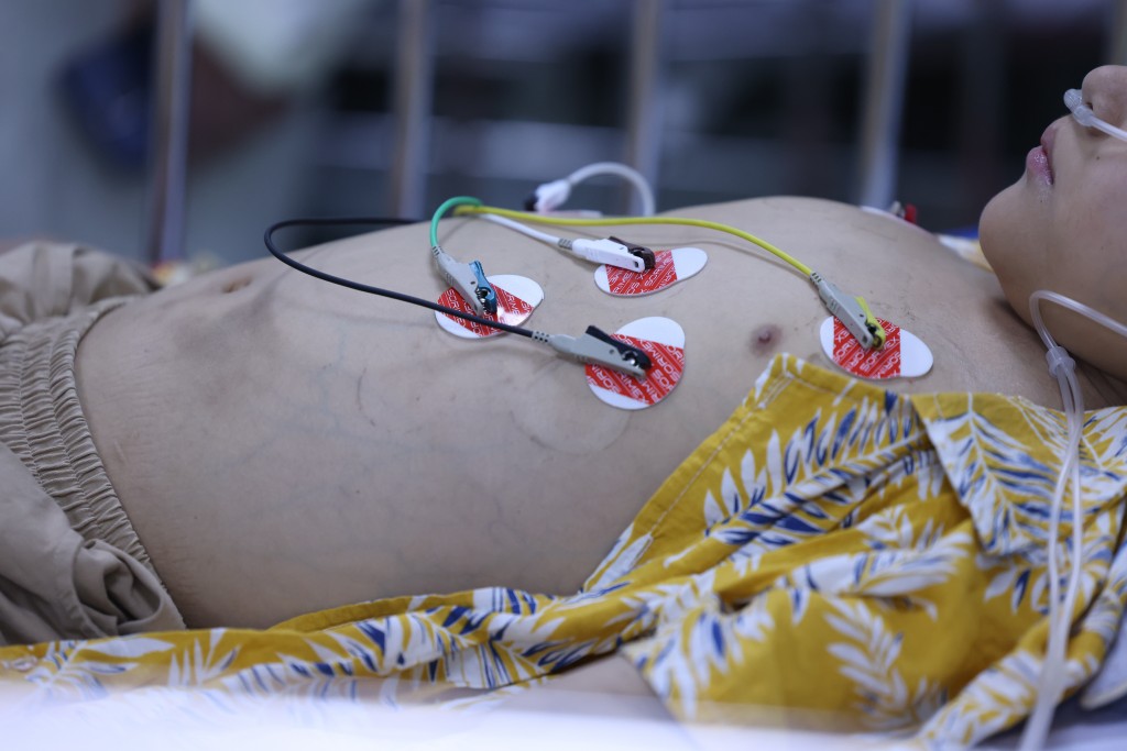 Những “màu đỏ không Tết” do Sốt xuất huyết Dengue