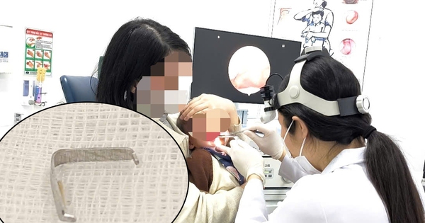 Ghim tất sắc nhọn mắc trong họng bé trai Ghim tất sắc nhọn mắc trong họng bé trai