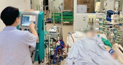 Thay huyết tương, sử dụng Ecmo cứu sống người phụ nữ suy hô hấp