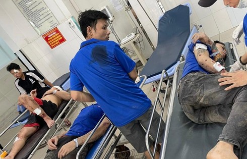 Cấp cứu, điều trị người bị nạn vụ nổ lò hơi tại Đồng Nai
