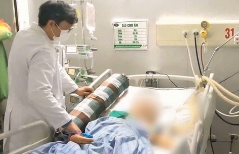 Bệnh nhân nguy kịch vì mắc viêm gan B 20 năm không điều trị