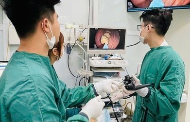 Người cao tuổi cảnh giác "tắc" bã thức ăn trong dạ dày