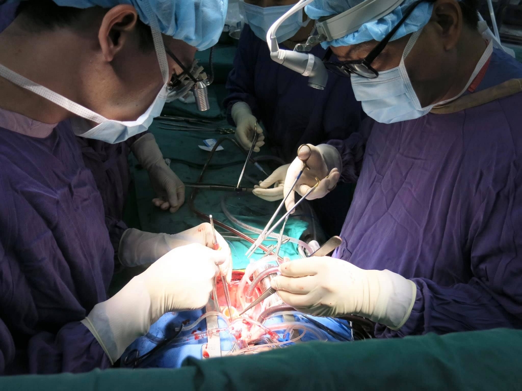 Các y bác sĩ tiến hành ca ghép tạng tại Bệnh viện Việt Đức