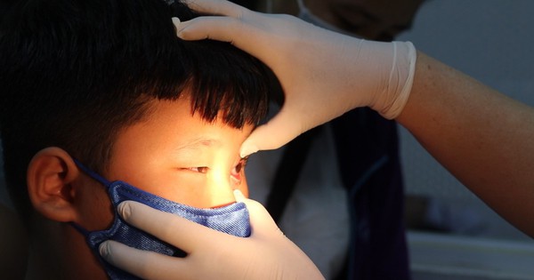 Đau mắt đỏ ở trẻ gia tăng cha mẹ cần phải biết 5 điều sau để nhanh khỏi và phòng bệnh
