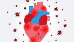 Di chứng tim mạch hậu COVID-19: Làm thế nào để chữa lành?