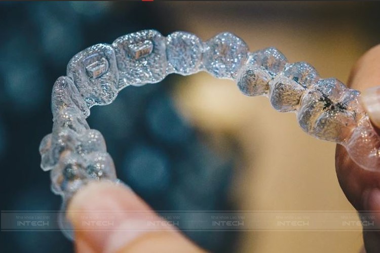 Khay niềng Invisalign được sản xuất trực tiếp tại Mỹ