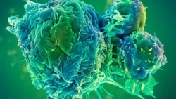 MSD ghi dấu ấn bằng liệu pháp miễn dịch điều trị ung thư tại Việt Nam