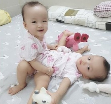 noi bat hanh song sinh dinh lien va su tai sinh ky dieu tu ban tay nhan ai