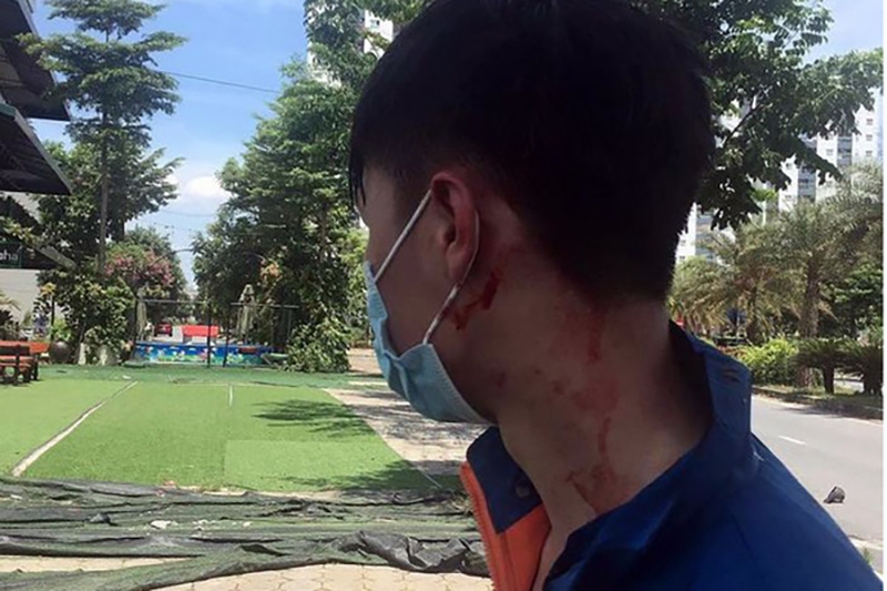 Anh Phạm Văn Khoa bị một trong 2 tên cướp đâm vào đầu, gây thương tích