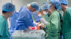 Cứu sống bệnh nhân xuất huyết tiêu hóa do rò động mạch chủ ngực, thực quản