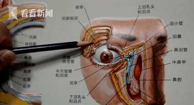 Rơi nước mắt khi ăn được(Ảnh: odditycentral) chẩn đoán là một bệnh lý hiếm gặp