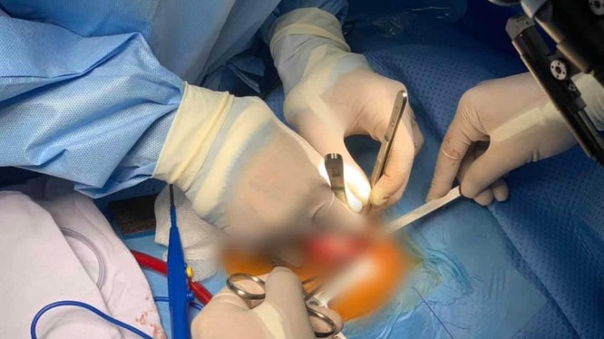 Các bác sĩ phẫu thuật cho bé .