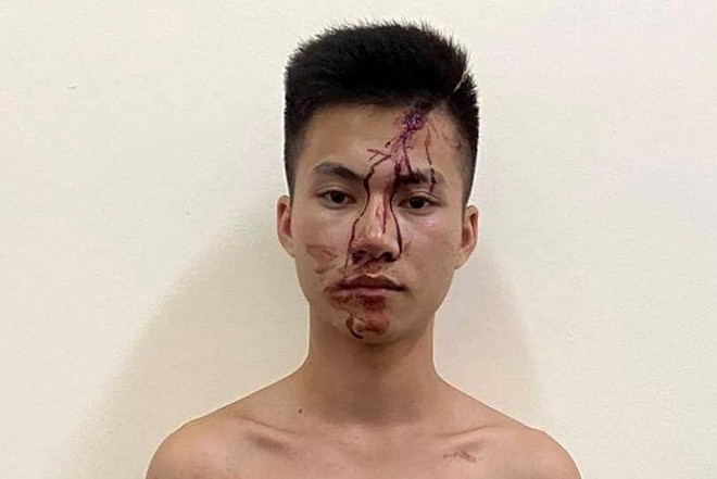 Thái Nguyên: Mâu thuẫn trong lúc chơi bi-a, nam thanh niên cầm dao đâm bạn tử vong